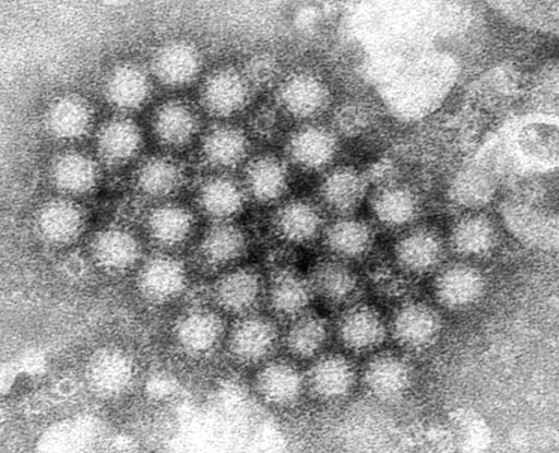 Imagen Sistemas de Salud en Estados Unidos y Reino Unido en alerta por norovirus, ¿Qué sucede?