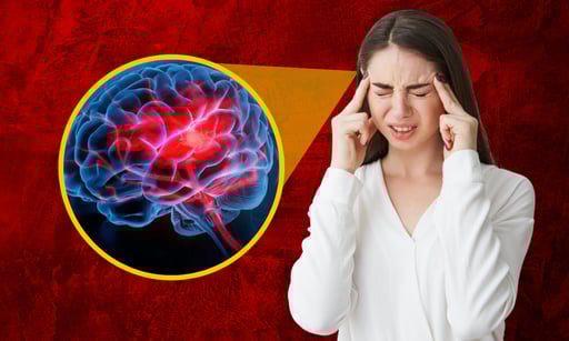 Imagen ¿Cómo diferenciar entre el dolor de cabeza y un derrame cerebral?