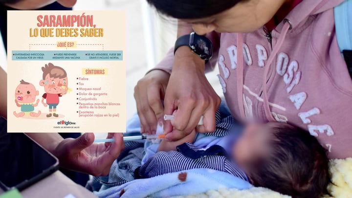 ¿Cuáles son los síntomas del sarampion y cómo prevenirlo?