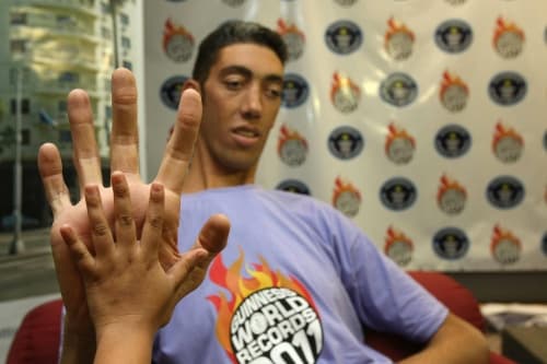 Hombre más alto del mundo no quiere crecer más