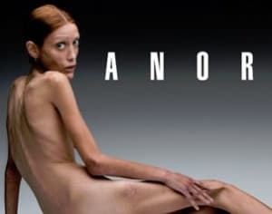 Isabelle Caro, de 28 años, fue conocida por protagonizar una campaña sobre trastornos alimenticios que fue captada por Oliviero Toscani.
