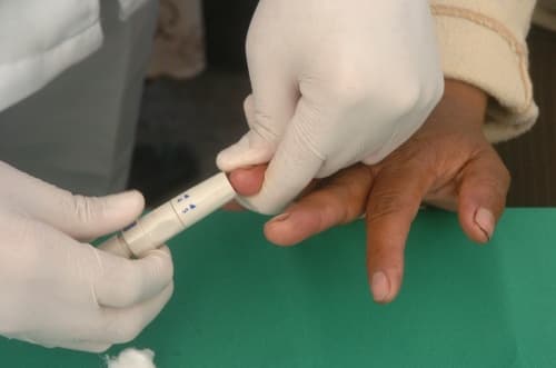 En México y en el mundo cada siete minutos se reporta la muerte de una persona a consecuencia de la diabetes y de acuerdo con reportes de la Organización Mundial de la Salud (OMS.)