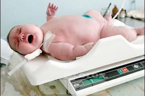 Saludable. Los recién nacidos con alto peso también tienen riesgos de salud.