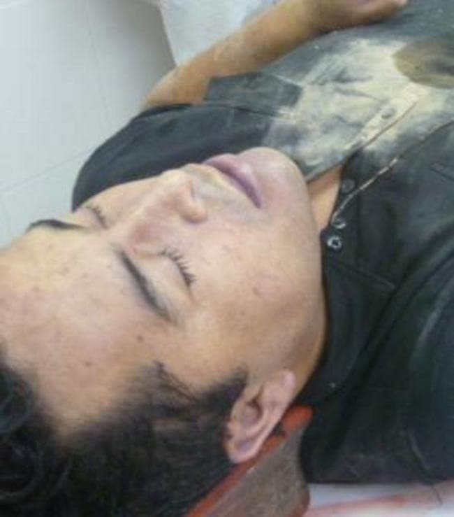 Según la necropsia al cadáver, el líder de 'Los Zetas' murió a causa de laceración y hemorragia cerebral intraparenquimatosa bilateral, choque hipovolémico y choque traumático.