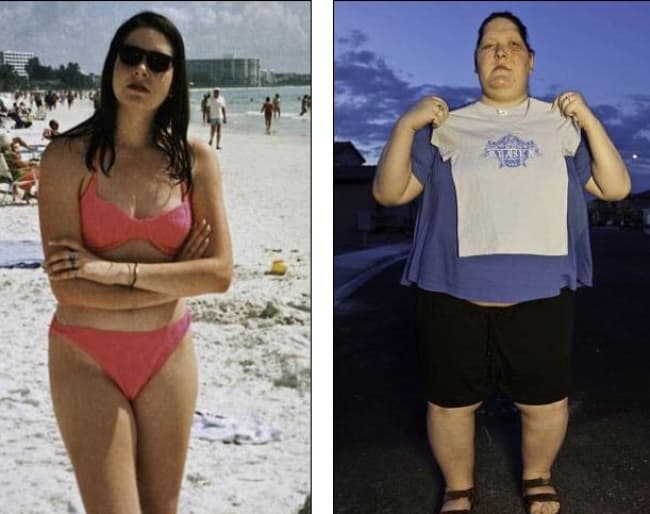 Angus fue víctima de una enfermedad rara llamada acromegalia, por la cual no paraba de crecer. Cuando afecta a los niños, el trastorno se conoce como gigantismo.