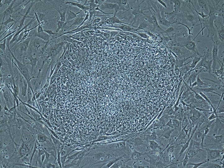 Las células madre, comprometidas para hacer neuronas, se podrían extraer de tejidos tanto del feto como de la propia madre y se trasplantarían en el feto mediante cirugía. (ARCHIVO)