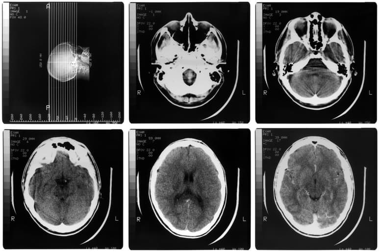 Los resultados de este trabajo podrán ayudar a entender mejor enfermedades como la epilepsia o el alzheimer. (ARCHIVO)