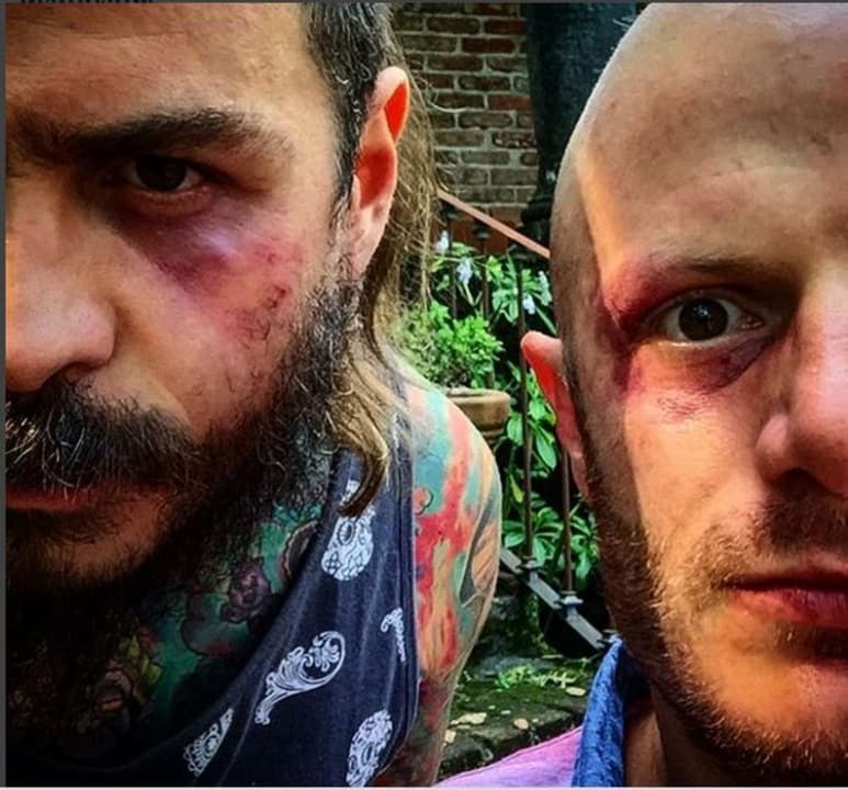¿Pelea?. El conductor publicó una fotografía en donde se le puede ver con un ojo morado causado por la supuesta riña.