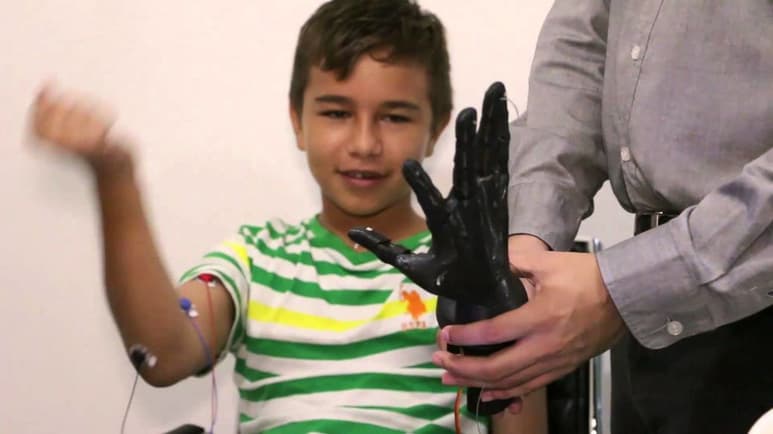 La fundación decidió que los dispositivos médicos terapéuticos fueran para los niños para facilitar la compra de prótesis a los padres. (ARCHIVO)