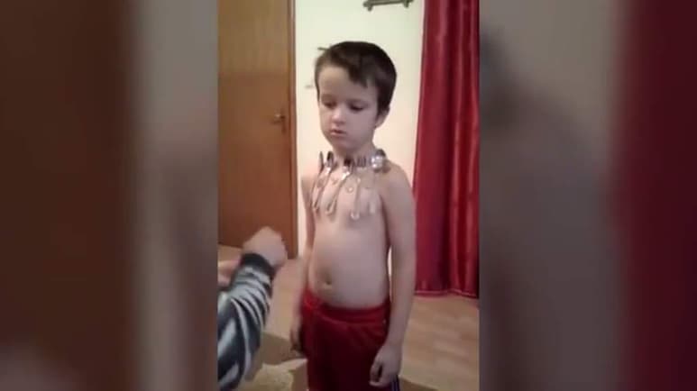 Es como un imán humano. (INTERNET)
