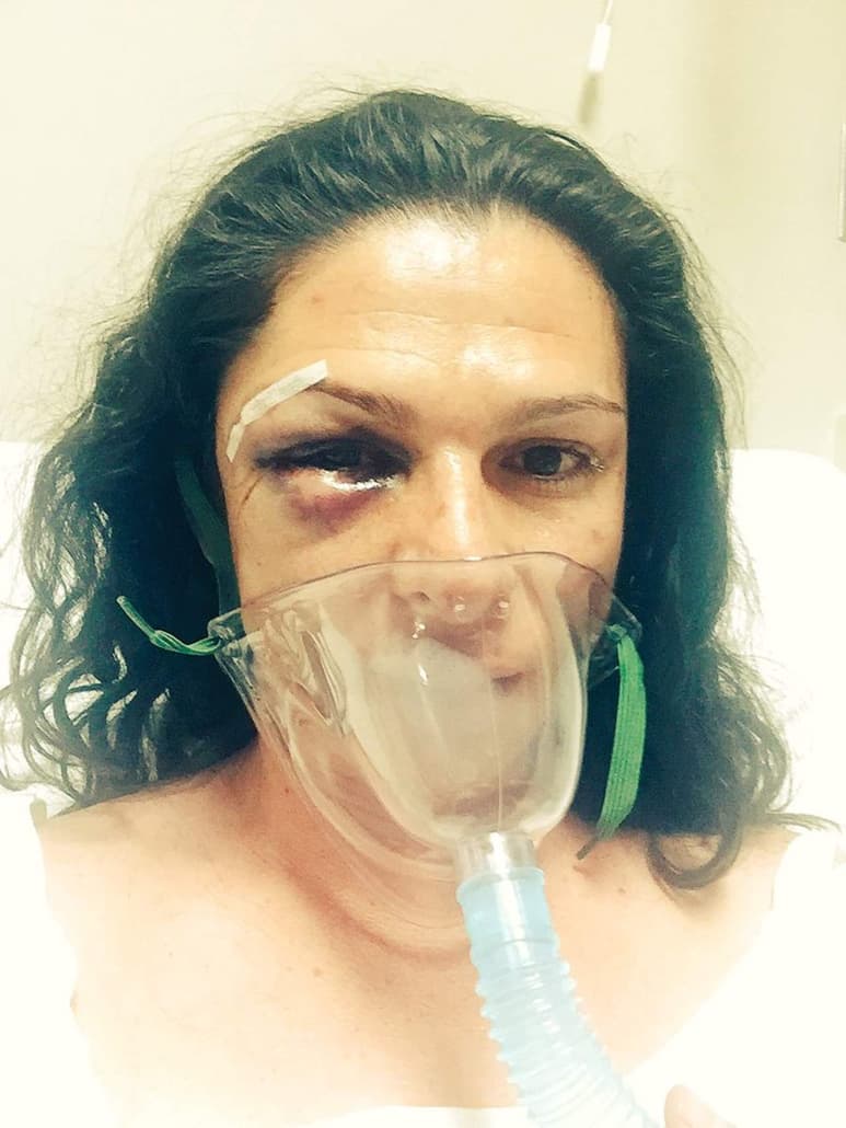 Sánchez Jiménez dijo que Ana Gabriela Guevara se trasladaba como lo hace usualmente en su motocicletas Harley-Davidson y los hechos ocurrieron en las inmediaciones de La Marquesa. (TWITTER)