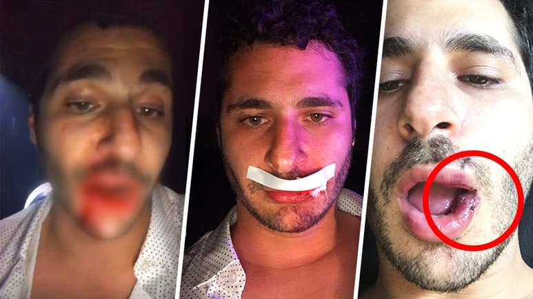 El youtuber fue golpeado por el ex novio de la chica con la que fue al antro. (YOUTUBE)