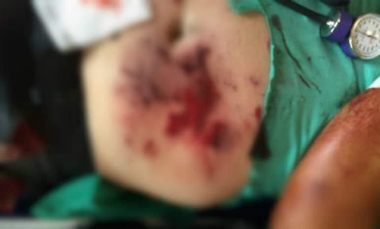 La detonación le ocasionó heridas en la mano izquierda, de acuerdo al diagnóstico del paramédico del Escuadrón de Rescate y Urgencias Médicas (ERUM). (ESPECIAL)