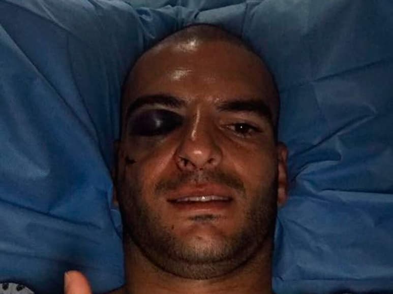 El cancerbero pasó la noche en un hospital de Querétaro. (Facebook)