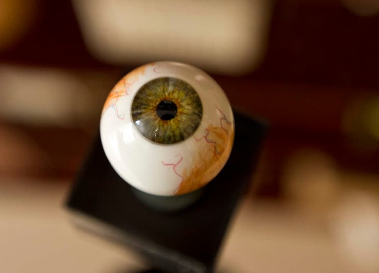 La directora de la Unidad de Medicina Familiar con Atención Ambulatoria alerto a la población que en muchos de los casos, el glaucoma no arroja síntomas evidentes. (ARCHIVO)