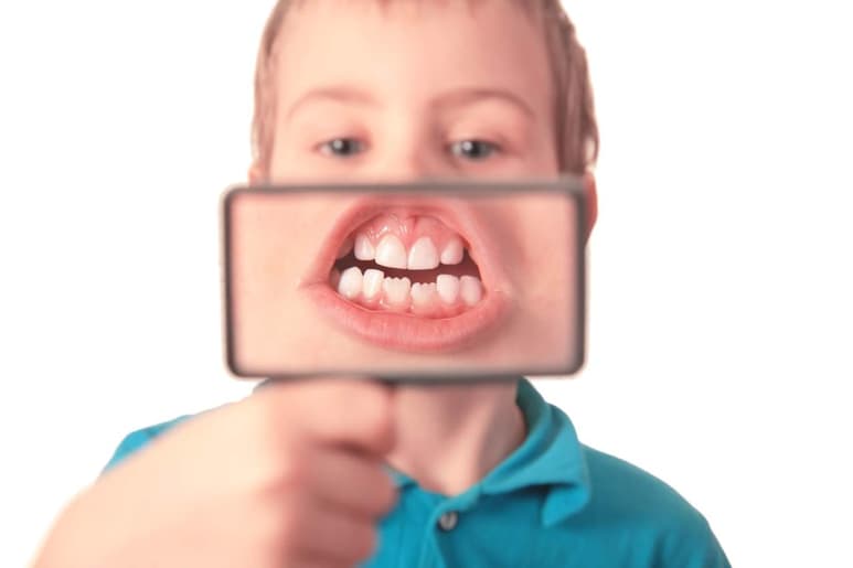se estima que las caries afectan a mas de 600 millones de niños, aunque dicho problema es prevenible. (ARCHIVO) 