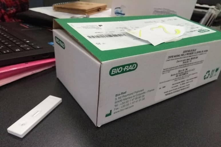 Uso. Prueba rápida para la determinación cualitativa en sangre total de anticuerpos IgG por Inmunocromatografía contra el VIH. (EL SIGLO DE TORREÓN)