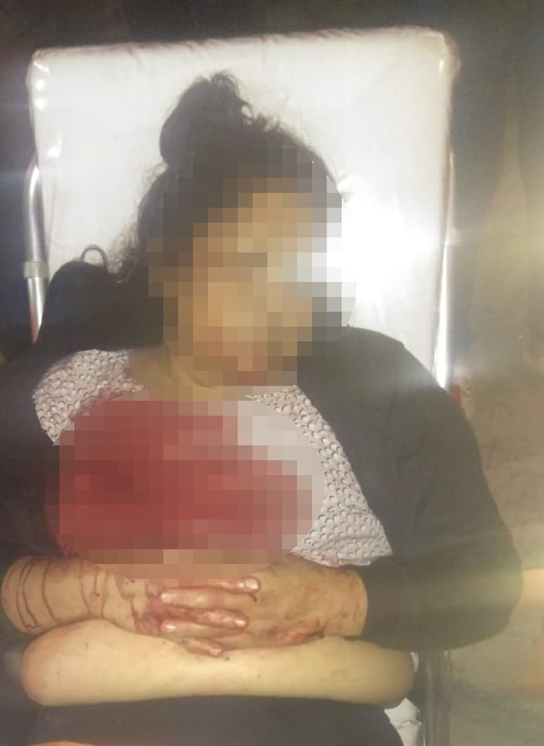Lesionada. La mujer fue llevada a un hospital de la región con varias heridas en el cuerpo. (EL SIGLO DE TORREÓN)