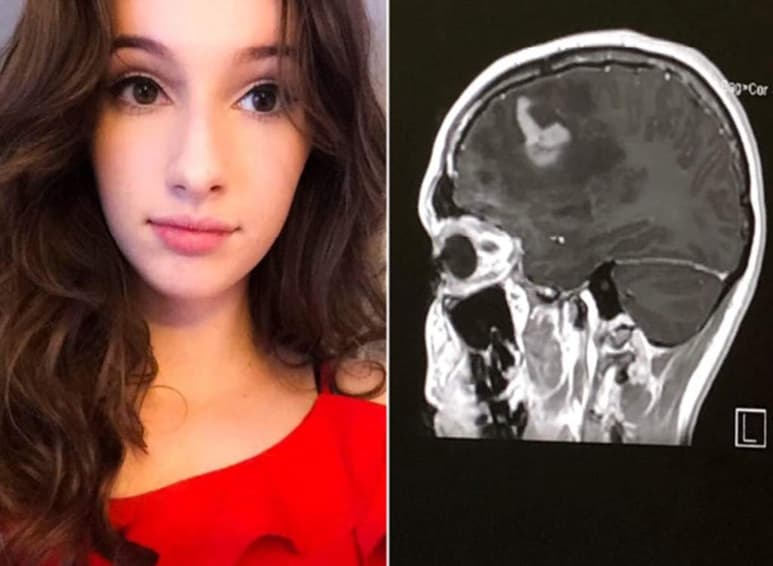 La joven ahora ayuda a crear conciencia sobre el tema. (INTERNET)