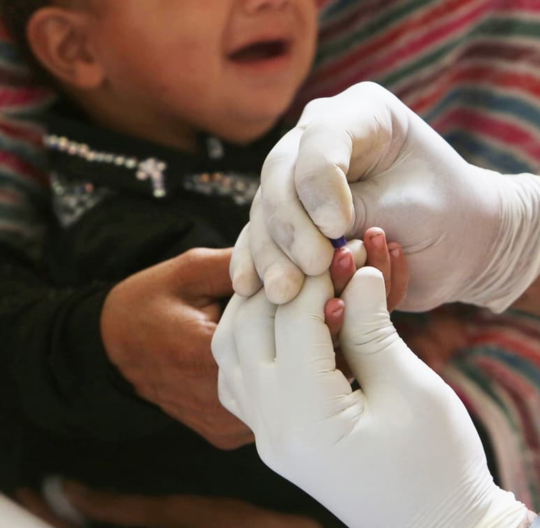 En el distrito de Larkana, 410 niños y 100 adultos dieron positivo a VIH, confirmó el jefe del Programa de Control de SIDA. (AP)