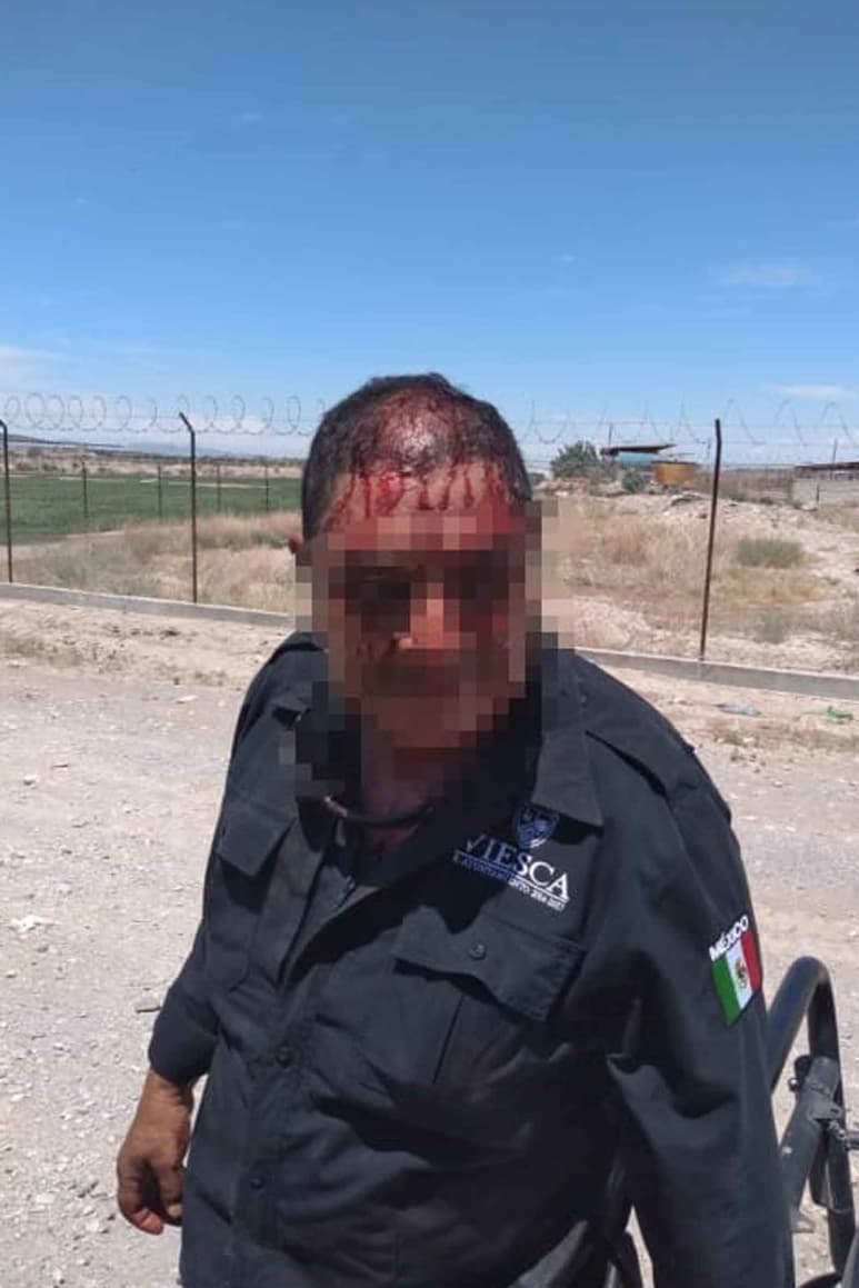 Agente preventivo es agredido por civil, Cruz Roja lo auxilió. (EL SIGLO DE TORREÓN)