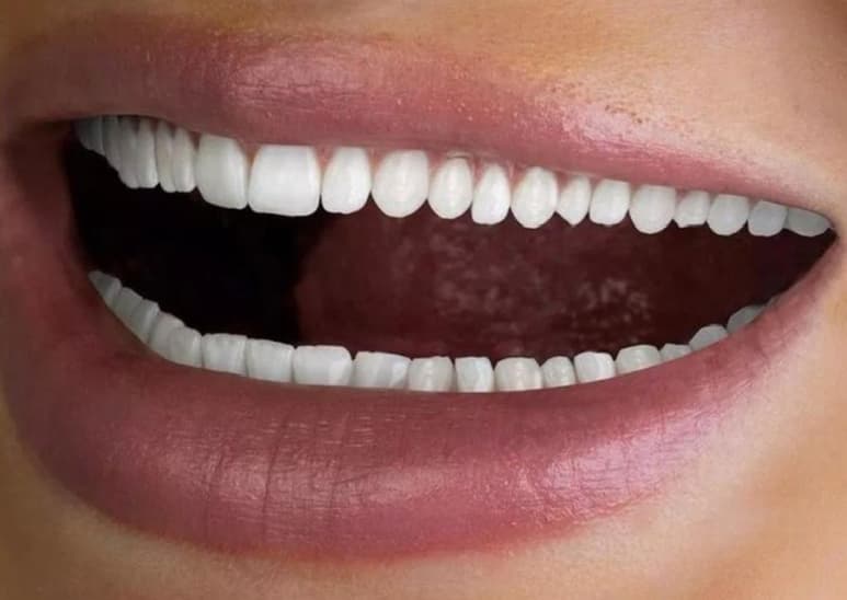 La gente que hay demasiados dientes para que sea normal. (INTERNET)