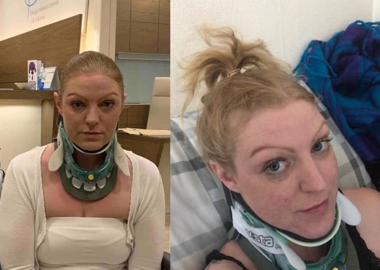 Necesita que médicos le fusiones el cuello con el cráneo. (INTERNET)