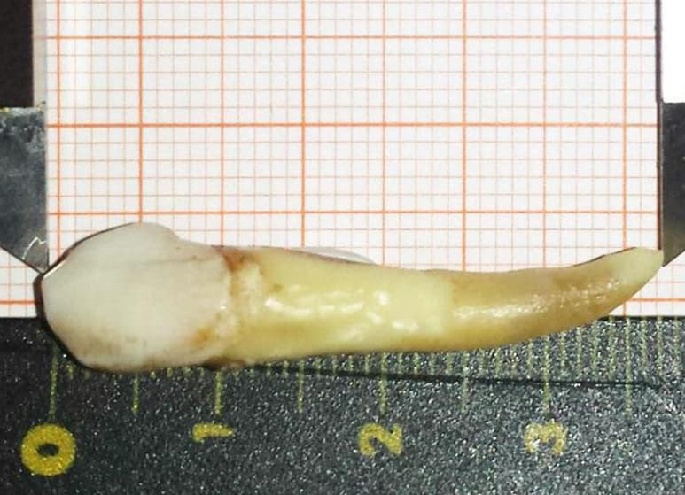 La pieza dental recibió certificado de récord Guinness. (INTERNET)