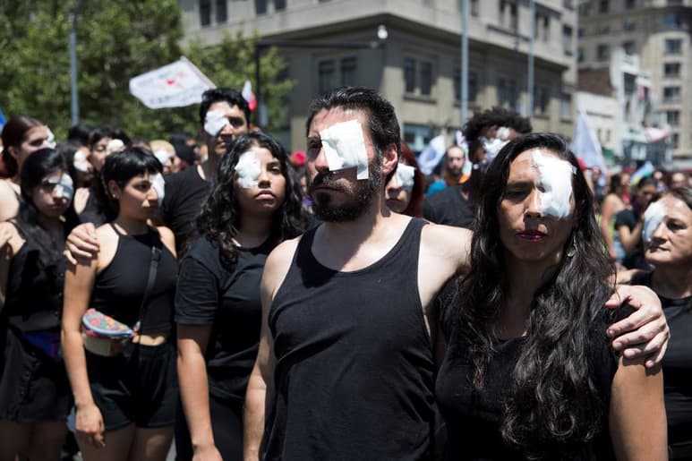 De las 241 personas con heridas oculares, 161 corresponden a trauma ocular. (ARCHIVO)