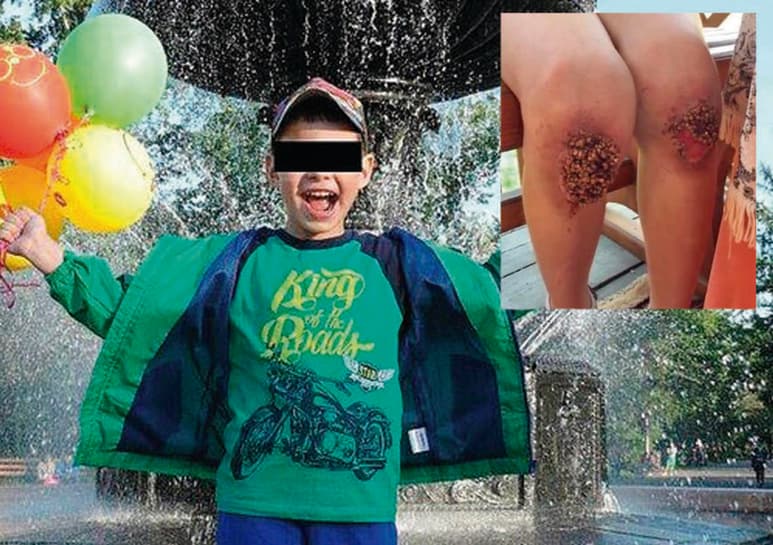 Los dos padres fueron acusados de maltrato infantil. (CAPTURA)