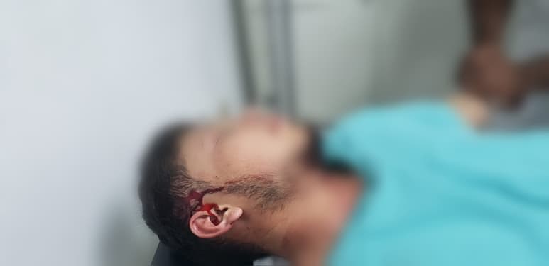 Hieren de bala a joven tras participar en riña en Gómez Palacio, el herido fue hospitalizado en Francisco I. Madero.