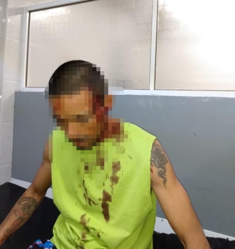 De acuerdo al reporte médico el joven presentó una lesión producida por arma de fuego, en pierna izquierda y región ciliar, así como herida cortante en la cara a causa de un batazo, en tanto que la mujer resultó policontundida. (EL SIGLO DE TORREÓN)