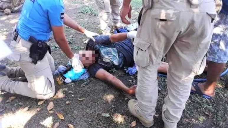 Dos turistas comenzaron a golpear al trabajador; primero le dieron con una botella y después otro sacó de su auto un machete y lo hirieron en la cabeza y en el brazo. (ESPECIAL)