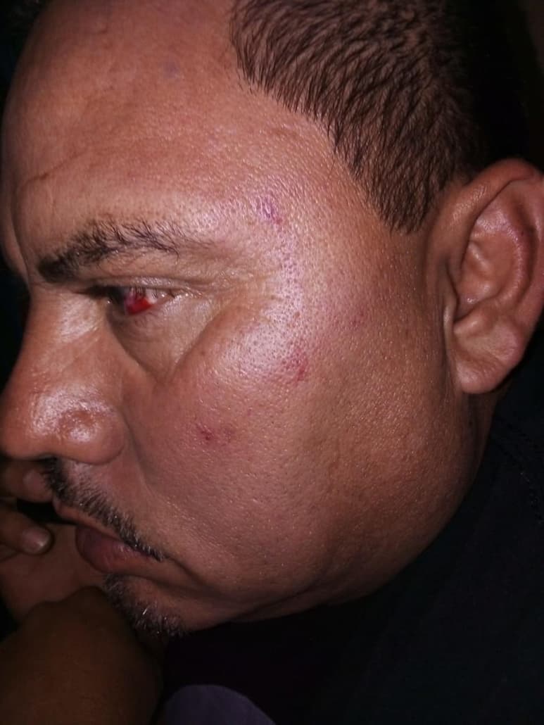 El expresidente del Comité Directivo Municipal del Partido Acción Nacional (PAN), en San Pedro, Aarón Vázquez, denunció formalmente ante el Ministerio Público al diputado local independiente, en Coahuila, Edgar Sánchez Garza, por agresiones, allanamiento de morada y amenazas de muerte contra él y su familia, motivo por el cual lo hace responsable de cualquier cosa que les pueda suceder. (EL SIGLO DE TORREÓN)