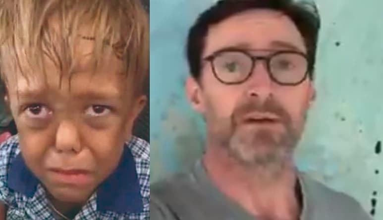 El menor se ha convertido en víctima de bullying, debido a que padece de enanismo (CAPTURA)