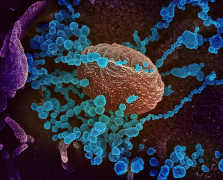 Una imagen de microscopio electrónico que muestra (objetos en azul) al SARS-CoV-2, el virus que causa el brote del coronavirus COVID-19, emergiendo de la superficie de las células cultivadas en el laboratorio. (EFE)