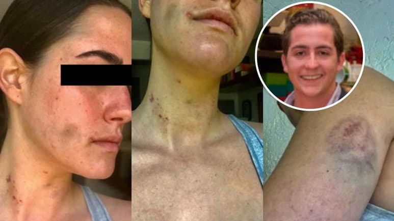 Una polémica publicación en redes sociales acusa al sobrino de Emilio Azcárraga Jean, presidente de Grupo Televisa, de presuntamente haber golpeado a una mujer con la que mantenía una relación sentimental. (ESPECIAL)