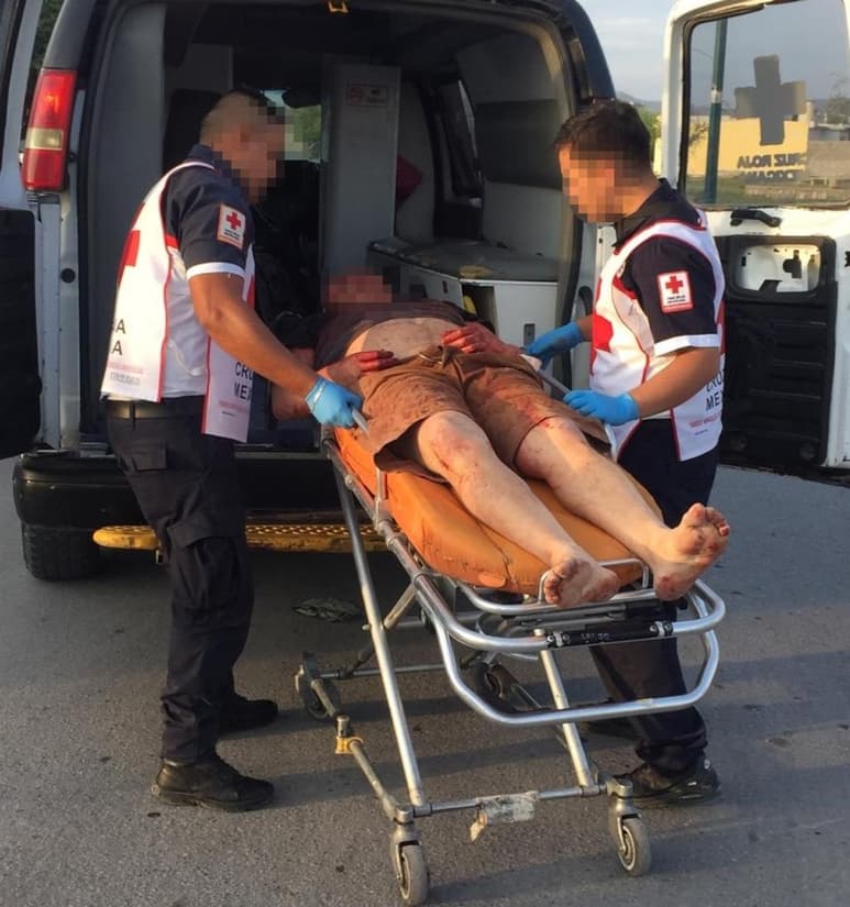 Hasta el lugar arribaron paramédicos de la Cruz Roja quienes le apreciaron al enfermero múltiples puñaladas en diferentes partes del cuerpo, así como una herida en la cabeza, trasladándolo hasta el Hospital General de Torreón, con un reporte de salud grave. (EL SIGLO DE TORREÓN)