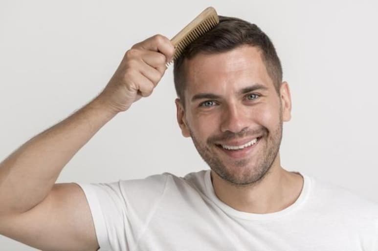 Un ensayo clínico demuestra que una solución tópica hecha a base de células madre lleva al crecimiento del cabello en personas con un tipo común de calvicie. (ESPECIAL)