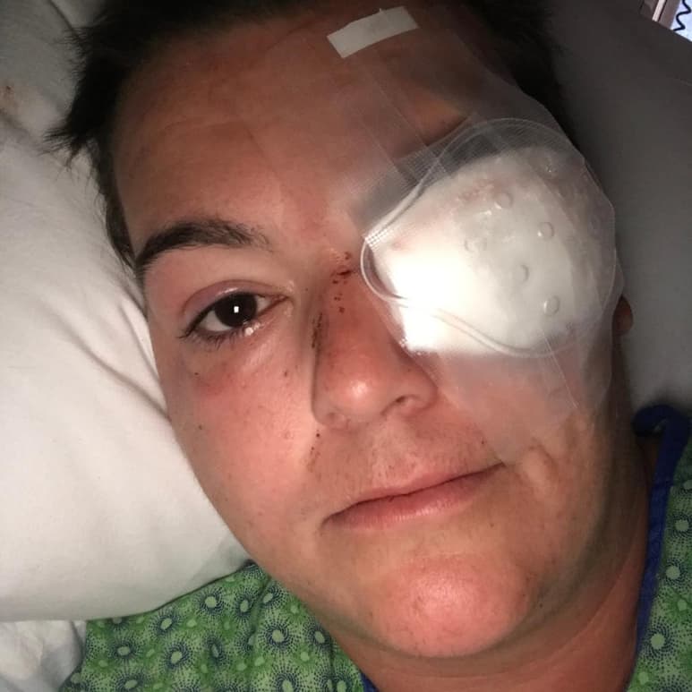 Acaba de perder el ojo izquierdo. Una bala de goma de la Policía de Minneapolis le impactó mientras cubría las protestas por la muerte de George Floyd, pero la fotógrafa y escritora Linda Tirado tiene una visión muy clara de lo que sucede estos días en EUA. (ESPECIAL)