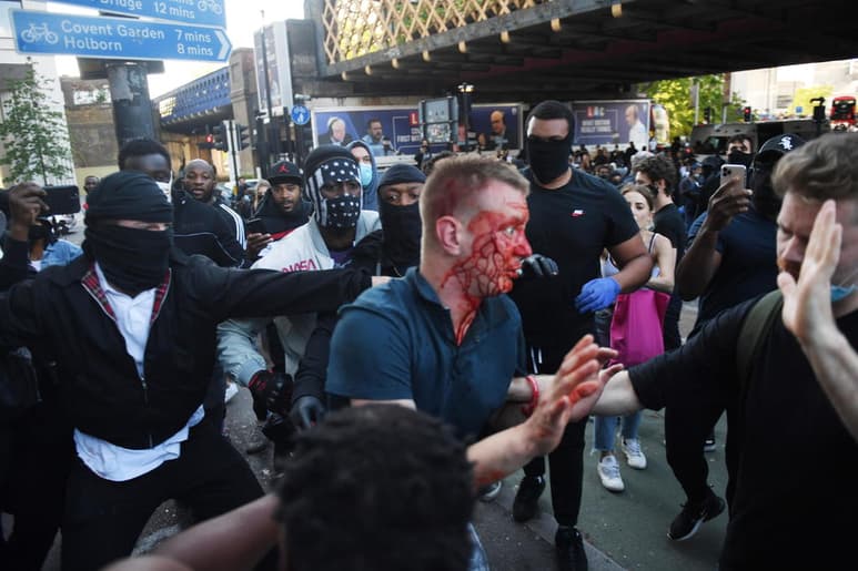 Según el Servicio de ambulancias de esta capital, seis de los heridos fueron hospitalizados y dos agentes fueron atendidos en la calle tras los fuertes forcejeos entre los manifestantes y los policías que trataban de evitar incidentes violentos.
(EFE)