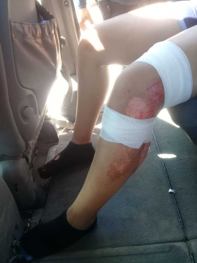 Paramédicos atendieron a las dos mujeres, las cuales presentaron heridas y golpes diversos en distintas partes del cuerpo.