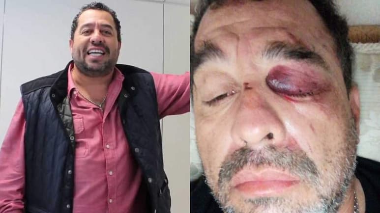 El conductor Juan Carlos “El Borrego” Nava recibe el apoyo de usuarios de redes tras sufrir un accidente motociclístico que lo dejó lastimado. (ESPECIAL)