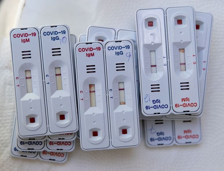 Ante la emergencia sanitaria por el COVID-19, se estableció un protocolo de evaluación para la aplicación de las pruebas rápidas. (AGENCIAS)