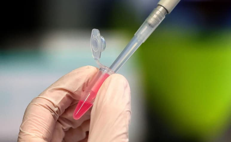 Las autoridades rusas aprobarán la vacuna contra la COVID-19 creada por el Instituto moscovita Gamaleya el 10 de agosto o incluso antes, adelantándose a EUA como sucedió con el Sputnik. (ARCHIVO)