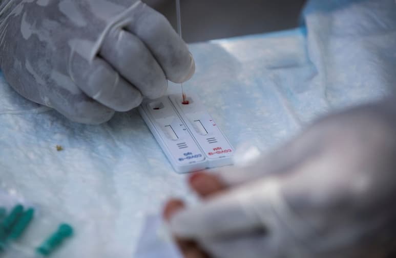 Las pruebas rápidas de COVID-19 se realizan mediante una muestra de sangre y son las que detectan inmunoglobulinas IgC/IgM. (AGENCIAS)