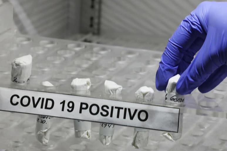 Nueve meses después de comenzar la pandemia de la COVID-19 que ha desatado la peor crisis del siglo, se acumulan las evidencias científicas que ha logrado una investigación sin precedentes, pero la ciencia y la tecnología escudriñan todavía numerosos aspectos desconocidos sobre el coronavirus y sus efectos. (ARCHIVO)