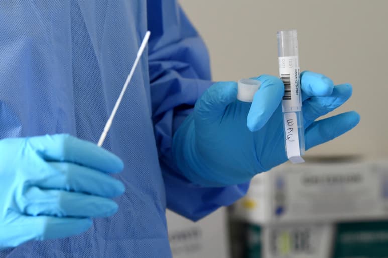 El pasado julio la farmacéutica estadounidense anunció el comienzo de la fase 3 de los ensayos. (AP)