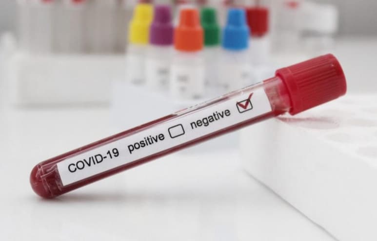Según el estudio, se han detectado más casos de COVID-19 en personas con sangre tipo A y AB (ESPECIAL)