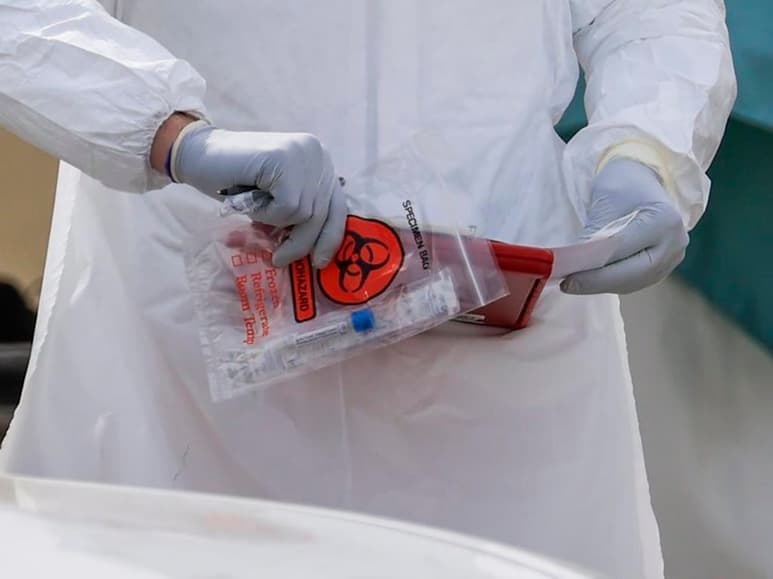 La Administración de Alimentos y Medicamentos de EUA, autorizó este miércoles la primera prueba de la COVID-19 para autodiagnóstico en casa, cuyo resultado se puede conocer en un máximo de 30 minutos. (CORTESÍA)